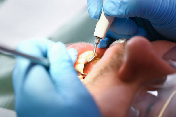 Best Emergency Treatment for Toothache in Lisbon, ND