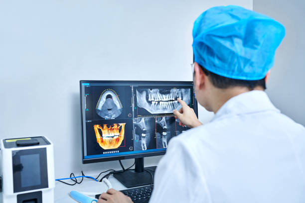 Best Emergency Wisdom Teeth Removal in Lisbon, ND